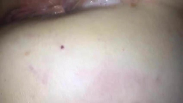 Whitley Asshole Ass Hole British Porn Her Ass Latina Ass Spit